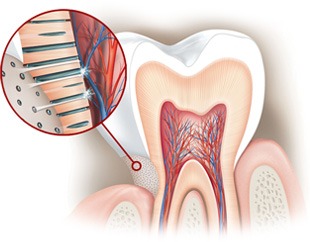 I tubuli dentali scoperti conducono al nervo lo stimolo doloroso