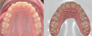 impronta ottica digitale dentale catania