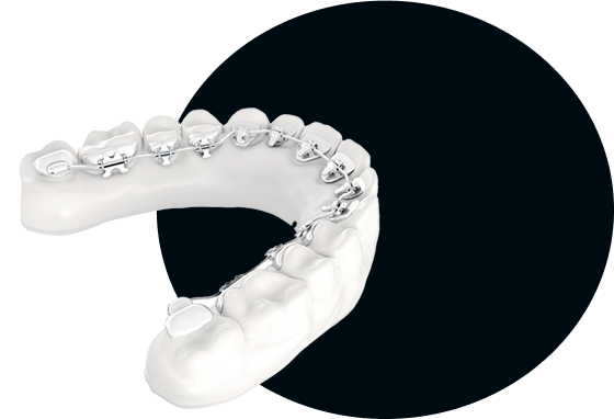 dentista-gallone-catania-ortodonzia-linguale-grafiche