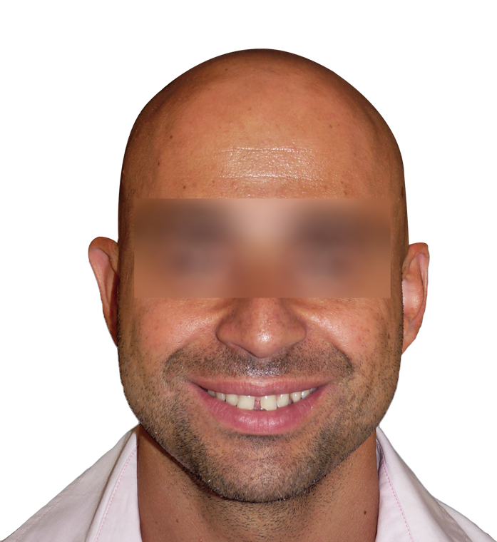 Faccia6A.png