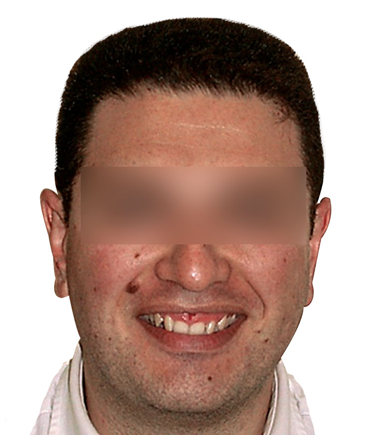 faccia21.jpg