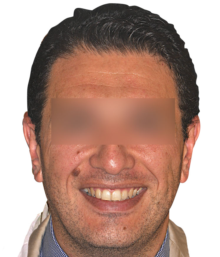 faccia22.jpg