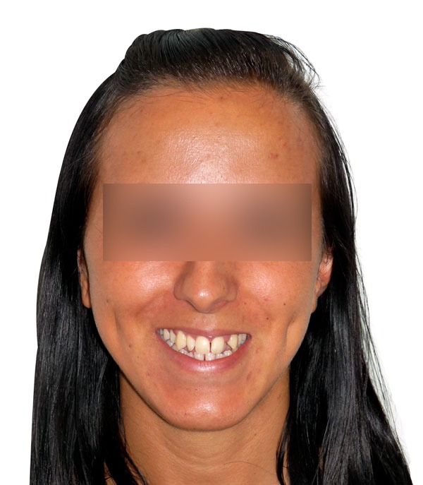 faccia31.jpg