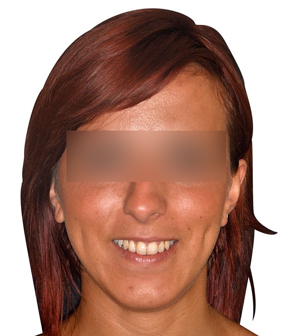 faccia32.jpg