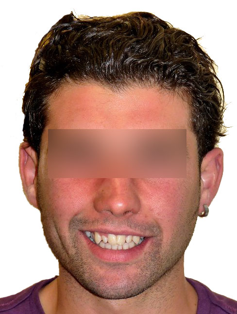 faccia41.jpg