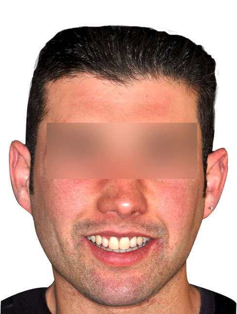 faccia42.jpg