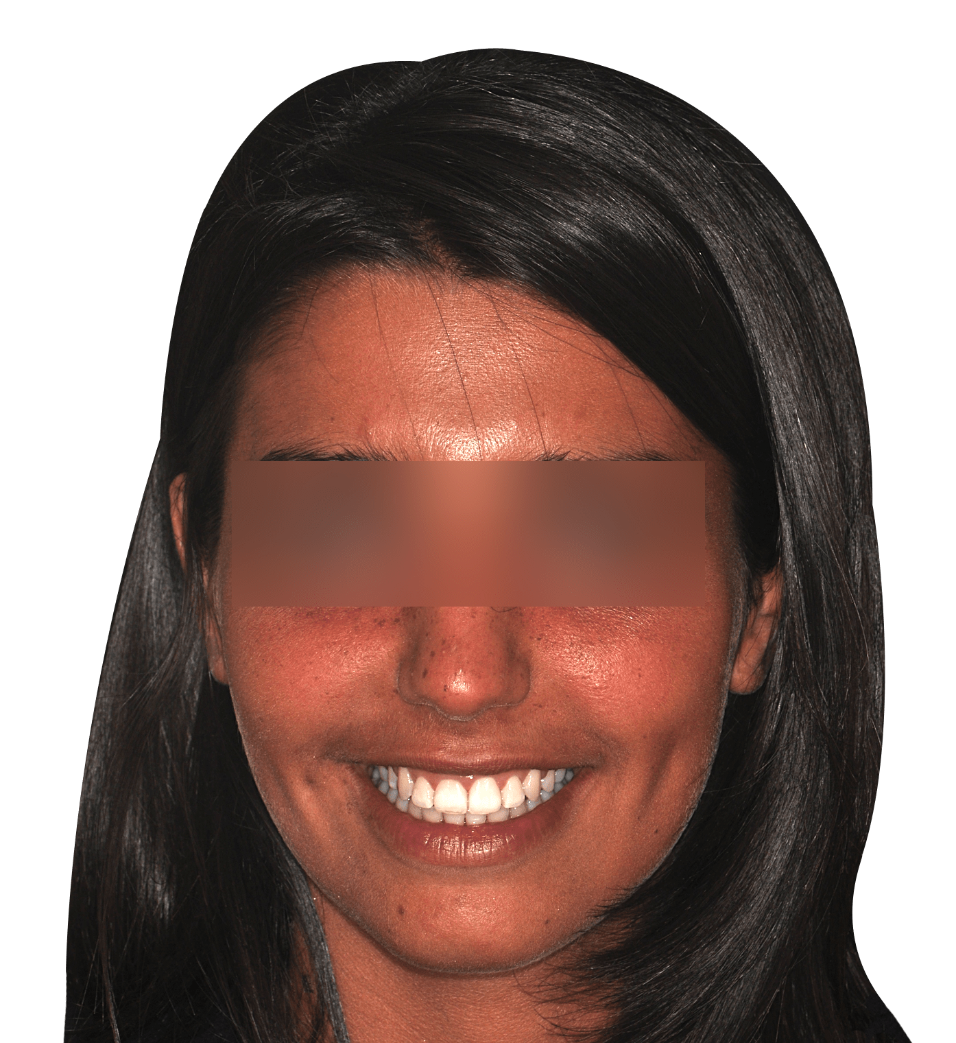 facciaB.png