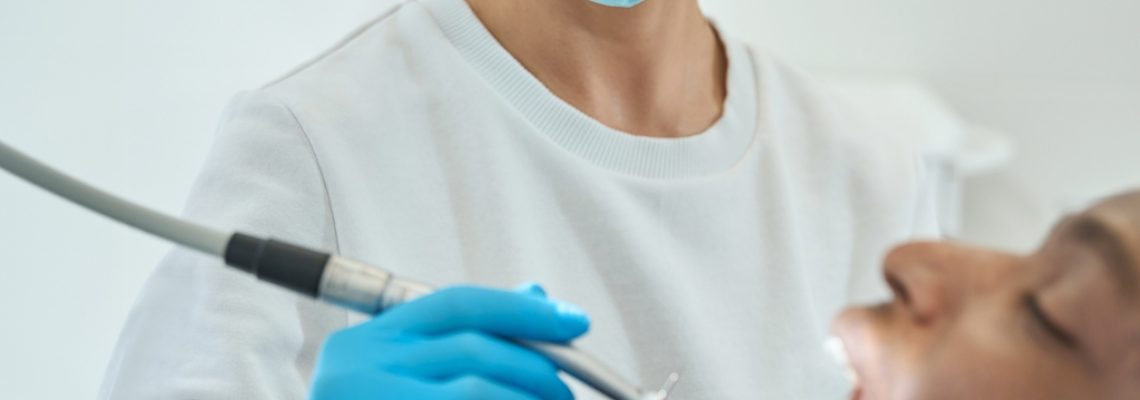 Pulizie dei denti a Catania - Gallone